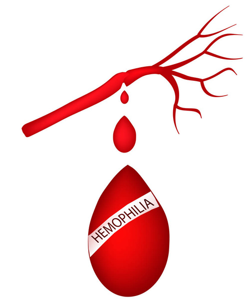 Wereld hemofilie dag. 17 April. Een druppel bloed stroomt van de slagader. Vectorillustratie - Vector, afbeelding