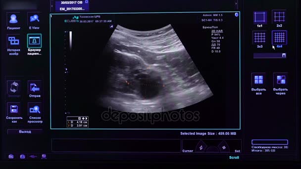 Imagem no monitor de uma máquina de ultra-som médica
. - Filmagem, Vídeo