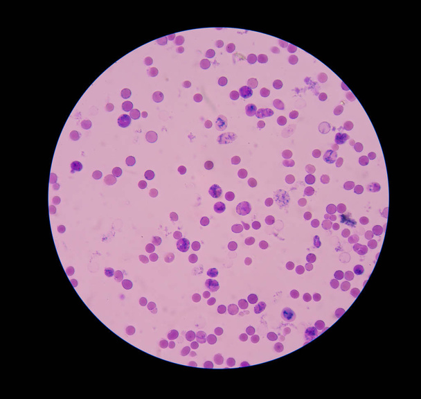 Retikulozyte mit roten Blutkörperchen auf Blutabstrichen. - Foto, Bild