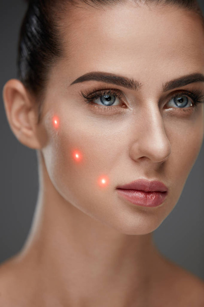 Beautiful Woman With Soft Skin And Red Laser Points On Skin - Foto, imagen