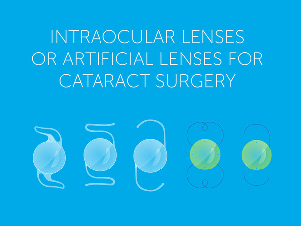 lentes intraoculares o lentes artificiales para cirugía de cataratas
  - Vector, Imagen