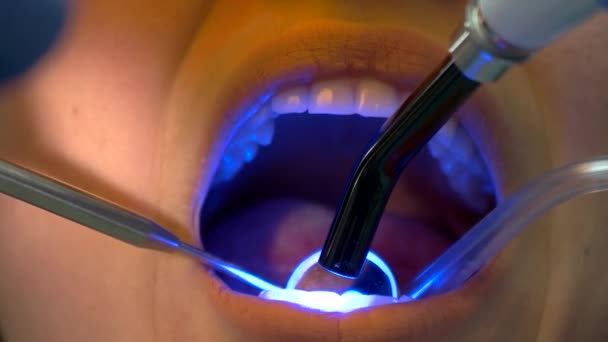 Dental pacjentów i utwardzania światłem. - Materiał filmowy, wideo