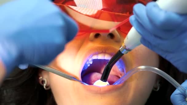 Dentysta jest za pomocą utwardzania światłem. - Materiał filmowy, wideo