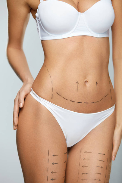 Beautiful Woman Body With Surgical Lines. Surgery Operation - Foto, Imagen