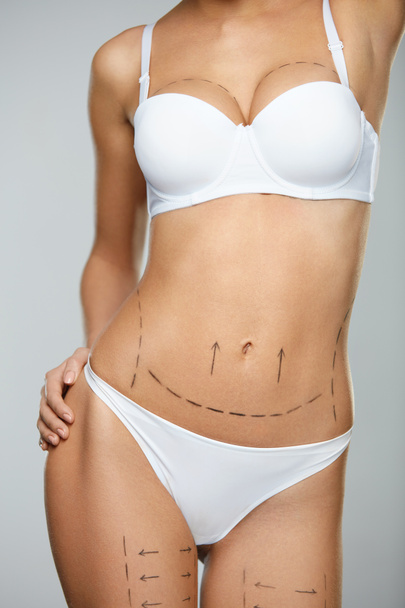 Hermoso cuerpo de mujer con líneas quirúrgicas. Operación quirúrgica
 - Foto, Imagen