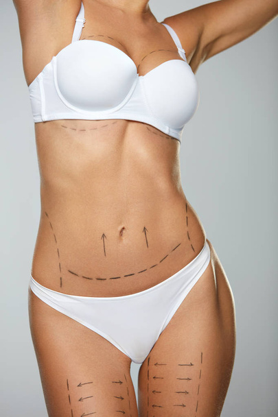 Beautiful Woman Body With Surgical Lines. Surgery Operation - Zdjęcie, obraz