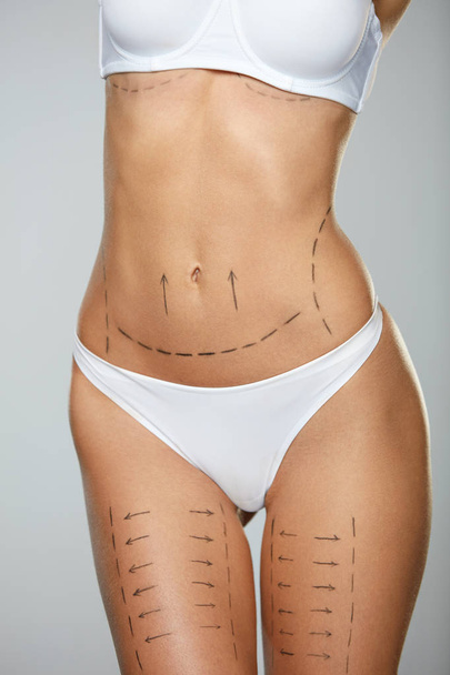 Surgical Lines. Woman Body In White Underwear With Marks On Skin - Foto, Imagen