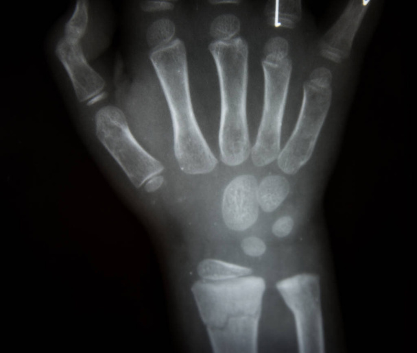 Film X-ray main
 - Photo, image