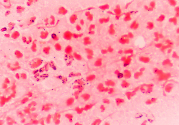 gram negative diplococci intracellular - Photo, Image