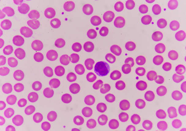 Normochromic normacytic rode bloedcellen - Foto, afbeelding