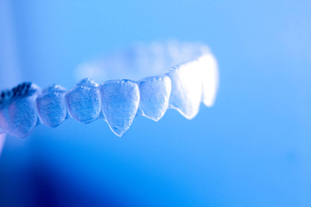 Aligneurs orthodontiques invisibles
 - Photo, image