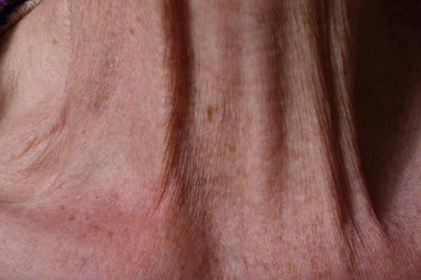 Морщины на шее пожилой женщины
 - Фото, изображение