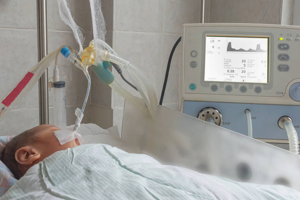 Nouveau-né sur appareil respiratoire en unité néonatale de soins intensifs
 - Photo, image