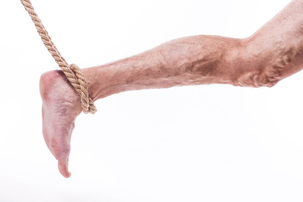 human leg with blocked veins and rope - Photo, Image