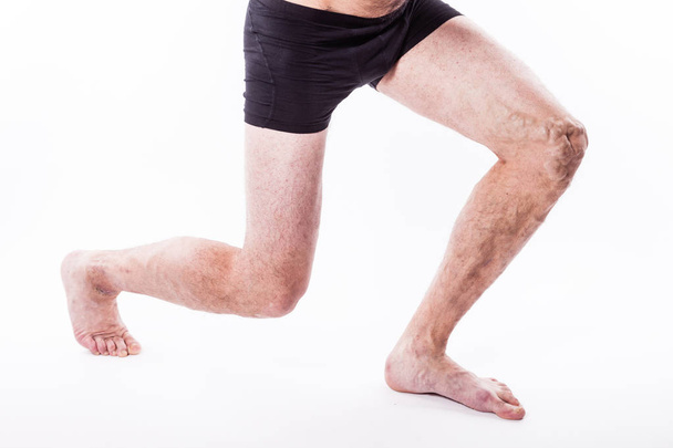 jambes humaines avec veines bloquées
 - Photo, image