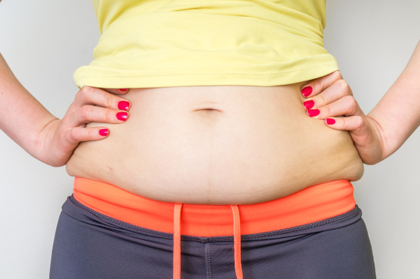 Corps de femme en surpoids avec graisse sur les hanches concept d'obésité
 - Photo, image