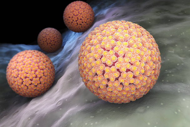 Virus del Papiloma. VPH
 - Foto, Imagen
