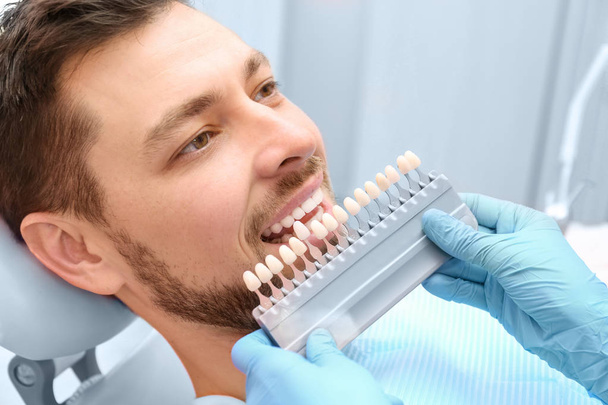 Dentist selecting color of teeth - Фото, зображення