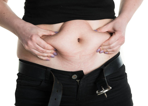 Mujer regordeta pellizcando su vientre gordo
 - Foto, imagen
