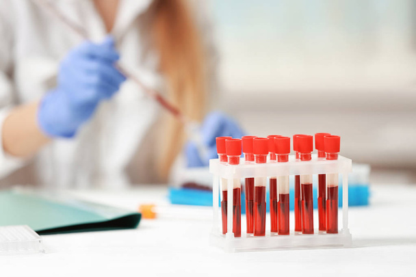 Test tubes with blood  - Fotografie, Obrázek