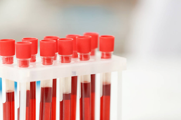 Test tubes with blood - Foto, Imagen