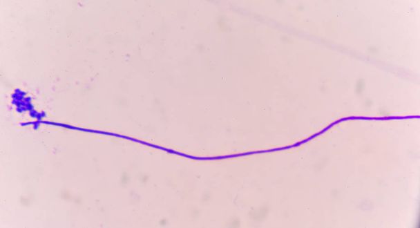Cellule di lievito con tessuto epiteliale
 - Foto, immagini