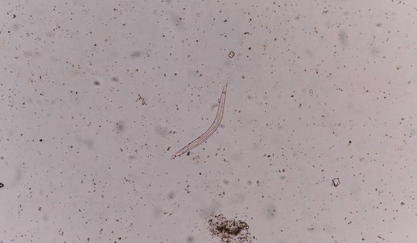 Strongyloides stercoralis (різьбовий черв'як) в табуреті
, - Фото, зображення