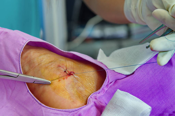 Enfermera sutura herida
. - Foto, imagen