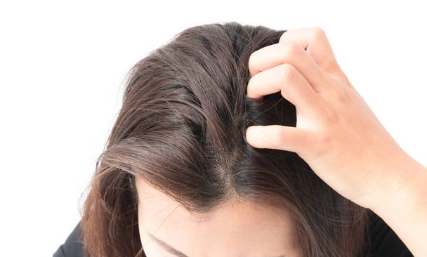Closeup mulher mão coceira couro cabeludo, conceito de cuidados com o cabelo
 - Foto, Imagem