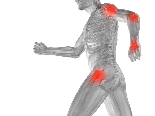 muscoli umani con dolore articolare o osseo
 - Foto, immagini