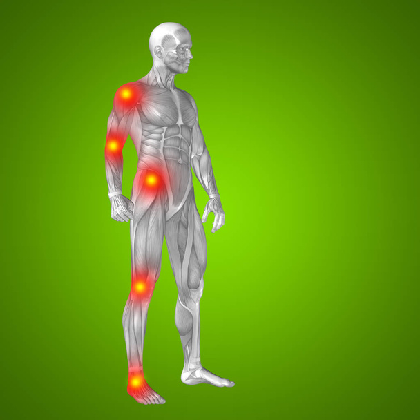 anatomía del cuerpo humano con signos de dolor
 - Foto, imagen