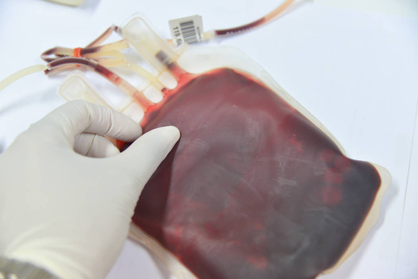 Kan torbası laboratuvar - Fotoğraf, Görsel