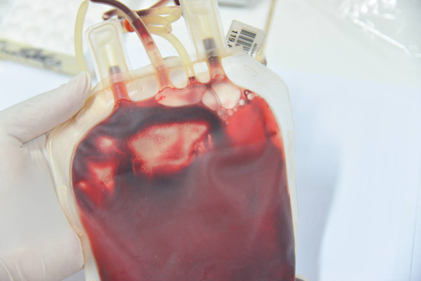 Sacchetto di sangue in laboratorio
 - Foto, immagini