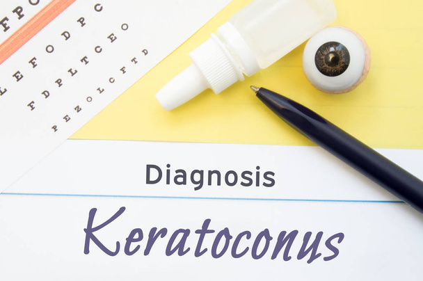 Chart for testing visual acuity, eye drops and eye anatomical model lies next to inscription Diagnosis Keratoconus. Concept for diagnosis, treatment and prevention of ophthalmic disease Keratoconus - Photo, Image