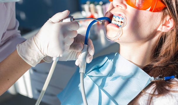 Bělení zubů postup v zubní ordinaci - Fotografie, Obrázek