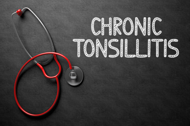 Tonsillitis crónica - Texto en pizarra. Ilustración 3D
. - Foto, imagen