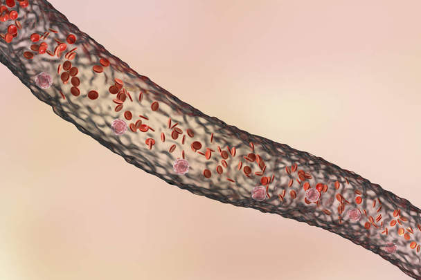 Vasos sanguíneos con células sanguíneas circulantes
 - Foto, Imagen