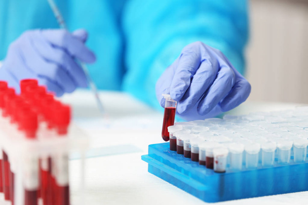 Scientist working with blood sample  - Photo, image