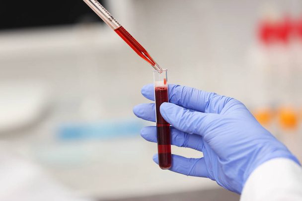 Cientista que trabalha com amostra de sangue
  - Foto, Imagem