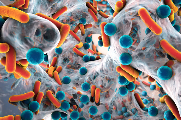 Biofilm antibiotikaresistenter Bakterien - Foto, Bild