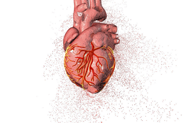 Concepto de enfermedad cardíaca
 - Foto, Imagen