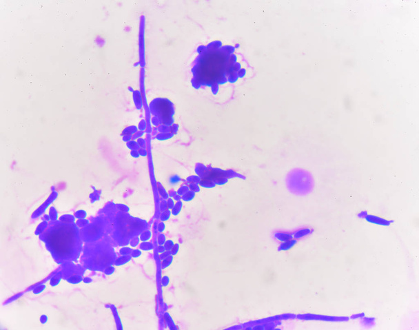 Budding yeast cells with pseudohyphae Gram stain method - Photo, Image
