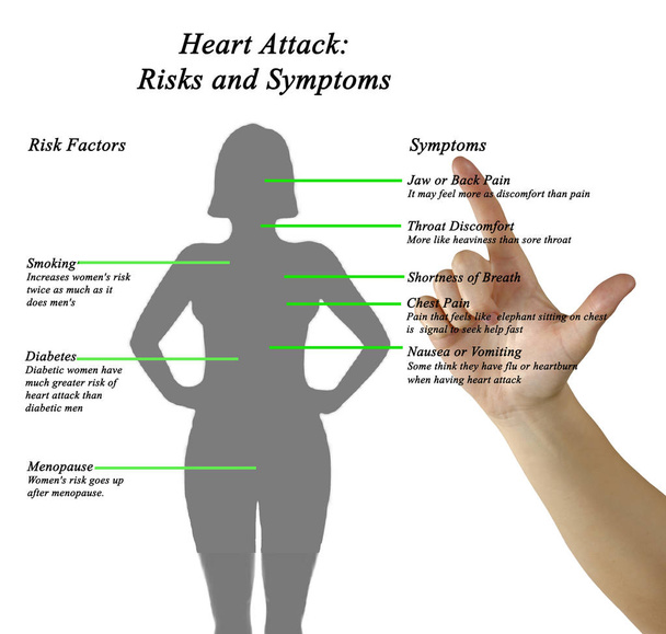 Diagrama de ataque cardíaco: Riesgos y síntomas
 - Foto, Imagen
