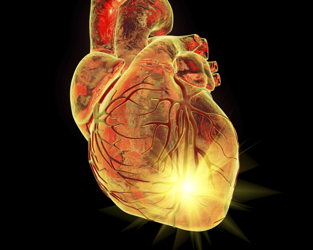 Καρδιακή προσβολή, εικονογράφηση coneptual - Φωτογραφία, εικόνα