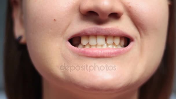 κορίτσι τέντωμα της στόμα και δείχνει τραύματος μετά από εξαγωγή δοντιού - Πλάνα, βίντεο