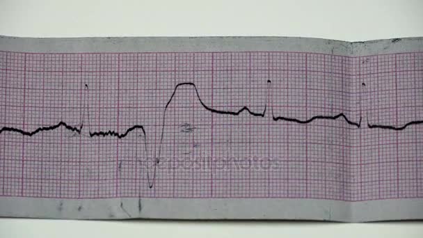 Paper tape with the record the schedule of heart. Cardiogram on a paper tape. - Footage, Video