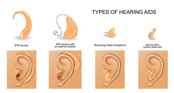 types of hearing AIDS - Vector, Image