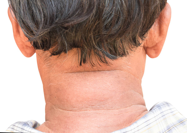Closeup wrinlkles on neck of old man wit white background - Valokuva, kuva