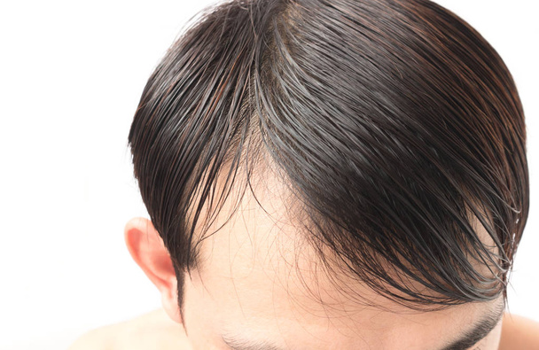 Joven hombre serio problema de pérdida de cabello para el cuidado de la salud champú y concepto de producto de belleza
 - Foto, Imagen