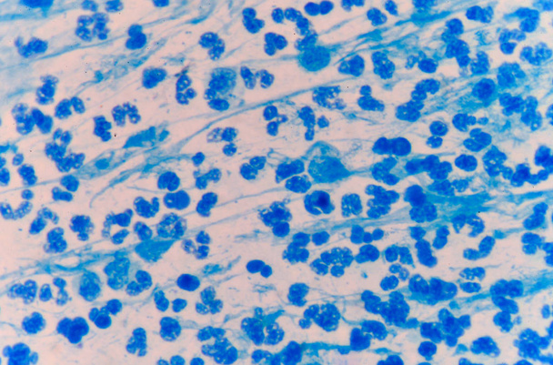 Orta mavi beyaz kan hücreleri. - Fotoğraf, Görsel